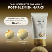 SKIN1004 Madagascar Centella TECA Cream – 75 mL