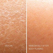 Body Plane Exfoliation Tool Set Esker