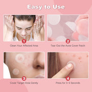 72 Counts Pimple Patches for Face Hydrocolloid Acne Patches for Face Invisible Zit Patches for Face Pimple Patch Acne Spot Patch Blemish Patches Cover Patches Stickers