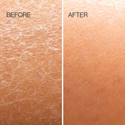 Body Plane Exfoliator Tool Esker