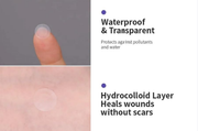 Magical Patch Hydrocolloid Pimple Patches – 36 Count