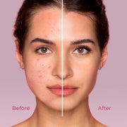 Rice Oil Makeup Remover Totemica Beauty