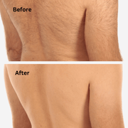 Sensilight™ Pro At-Home Hair Removal Sensica Inc.